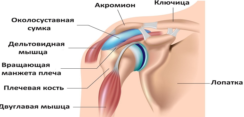 Схема локализации известкового бурсита плечевого сустава