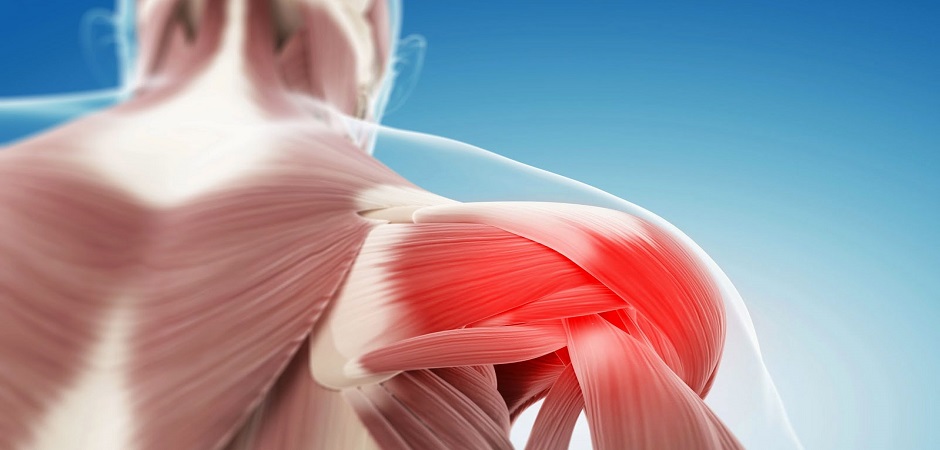Анатомия воспаления мышц (миозита) плеча