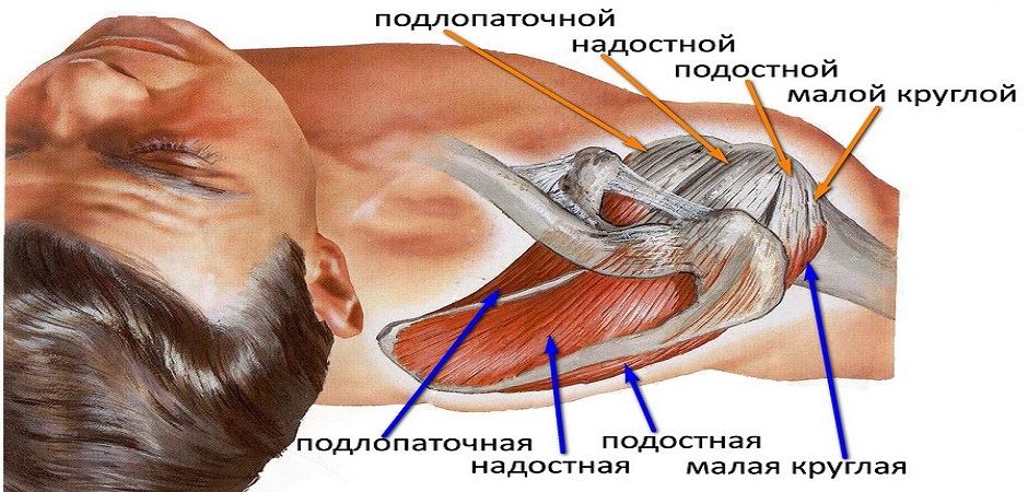 Тендинит подлопаточной мышцы. Схема