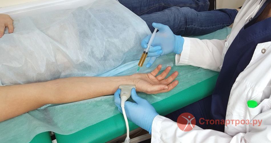 Лечение онемения кистей рук