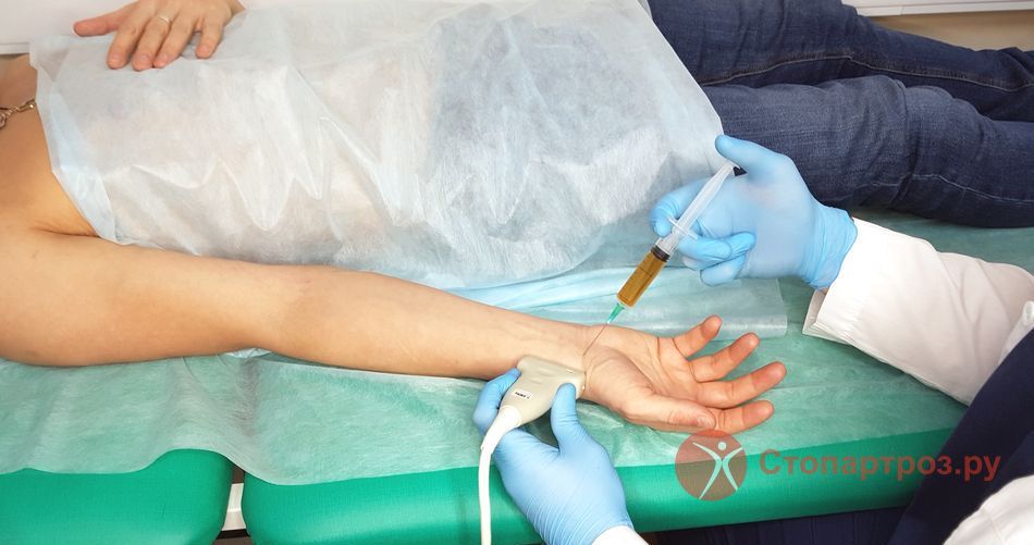 Лечение контрактуры суставов пальцев рук