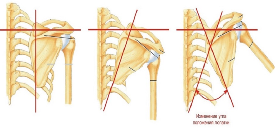 Лечения лопатка