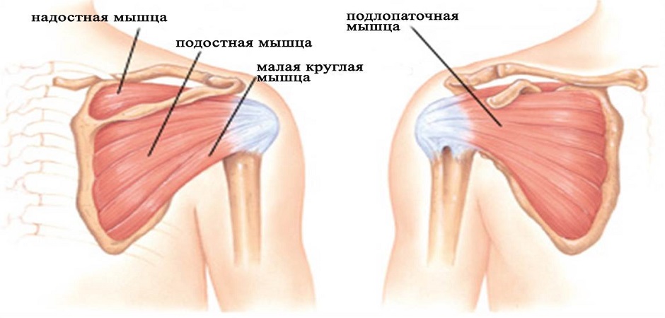 Схема разрыва подлопаточной мышцы
