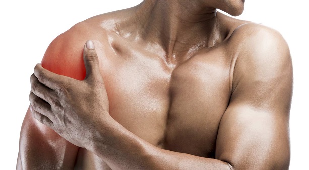 Разрыв сухожилия надостной мышцы