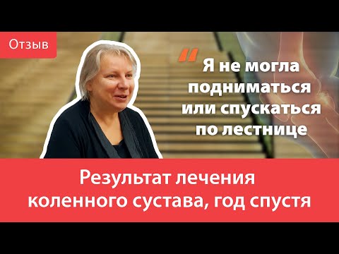 Результат лечения коленного сустава, год спустя